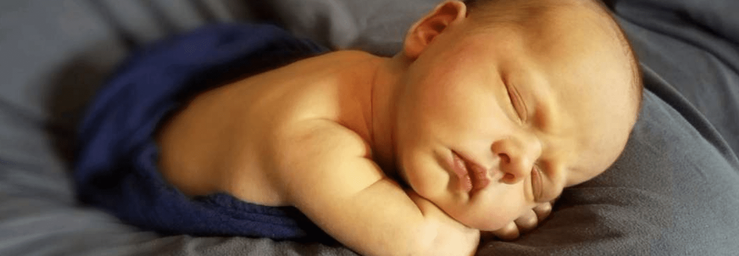 Ciri-ciri Penyakit Bayi Kuning dan Cara Perawatannya 