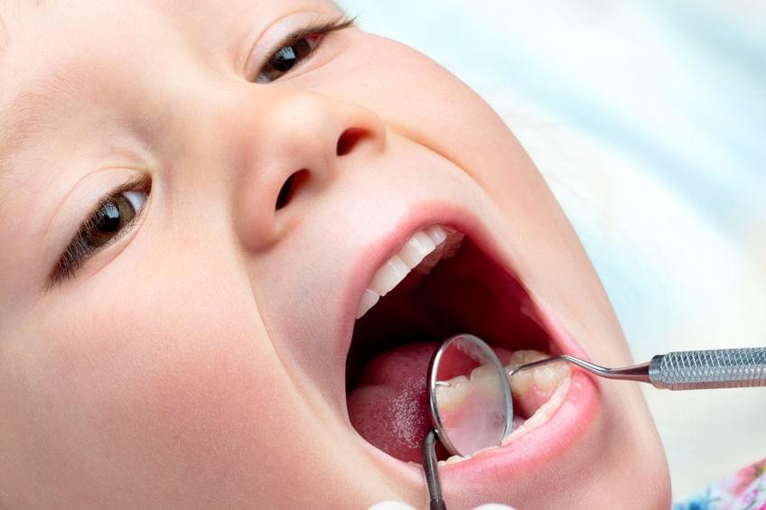 Manage Toothaches in the Little One Quickly and Effectively